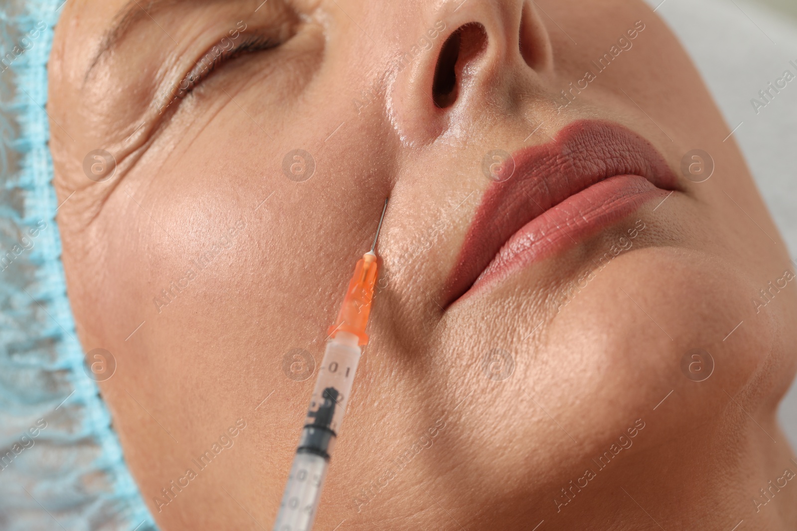 Photo of Senior woman getting facial injection, closeup. Cosmetic surgery