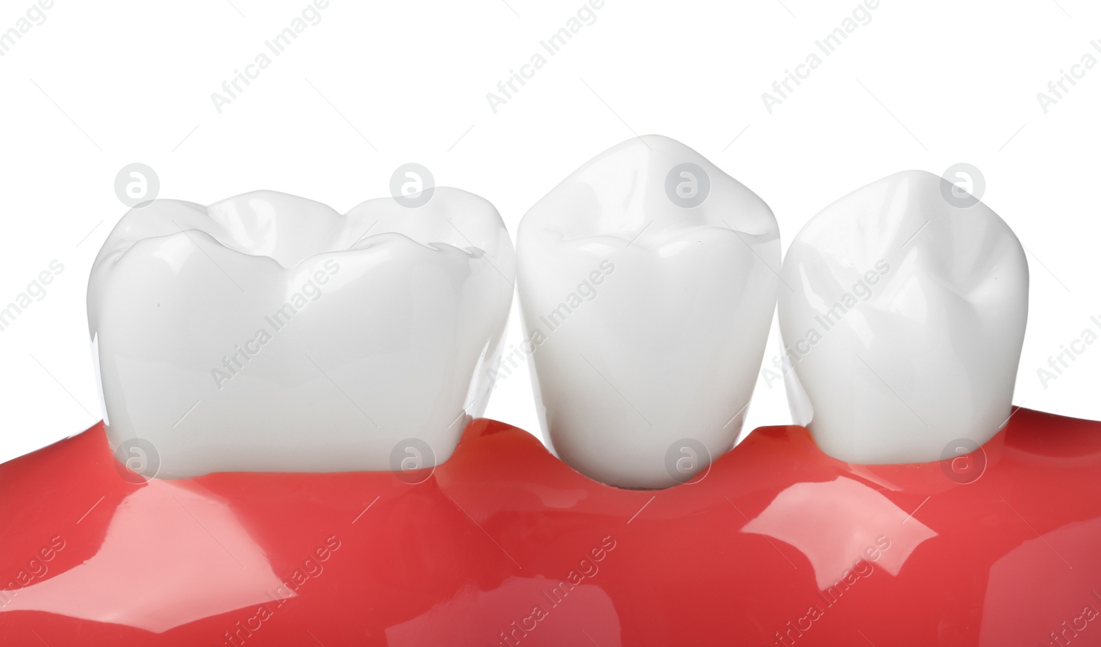 Photo of Educational model of gum with teeth on white background