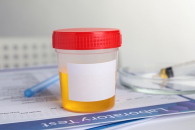 Photo of Container with urine sample for analysis on table in laboratory, closeup