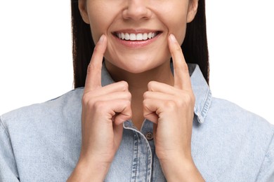 Woman showing her clean teeth and smiling on white background, closeup