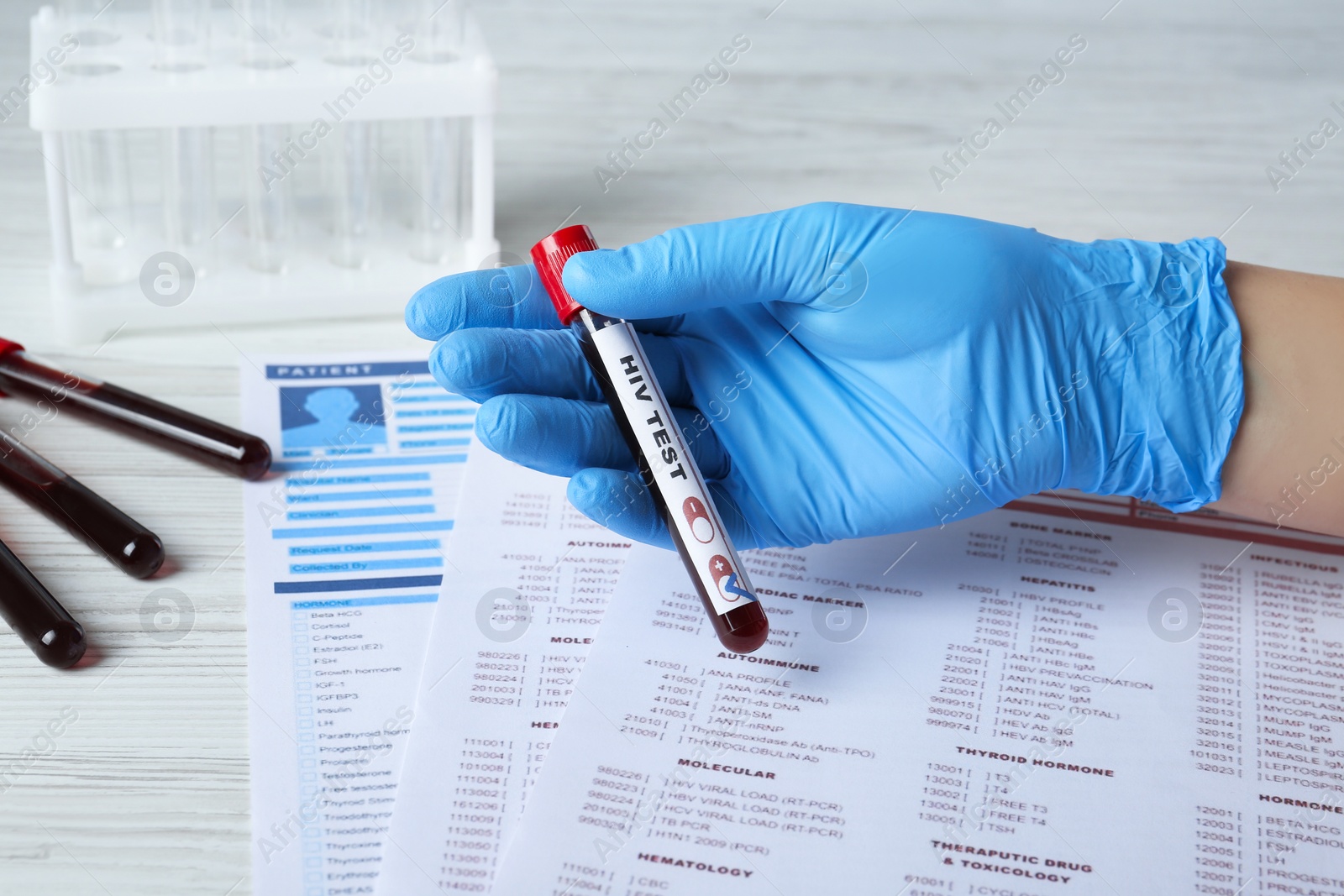 Photo of Scientist holding tube with blood sample and label HIV Test near laboratory form, closeup