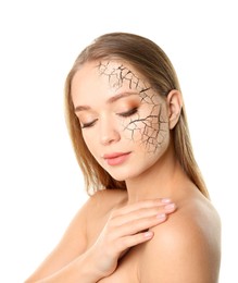 Image of Beautiful young woman with dry skin on white background