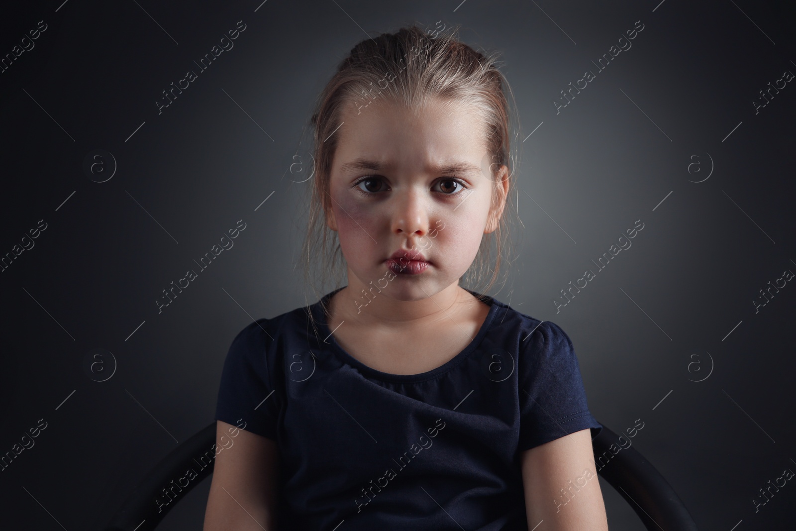 Photo of Little girl with bruises on face against dark background. Domestic violence victim