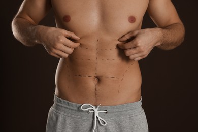 Photo of Fit man with marks on body against dark brown background, closeup. Weight loss surgery