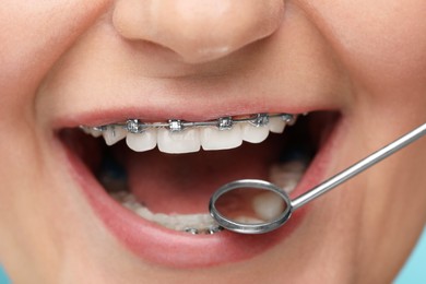 Examination of woman's teeth with braces using mirror tool, closeup