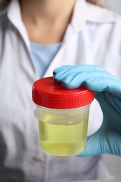 Photo of Doctor holding container with urine sample for analysis, closeup