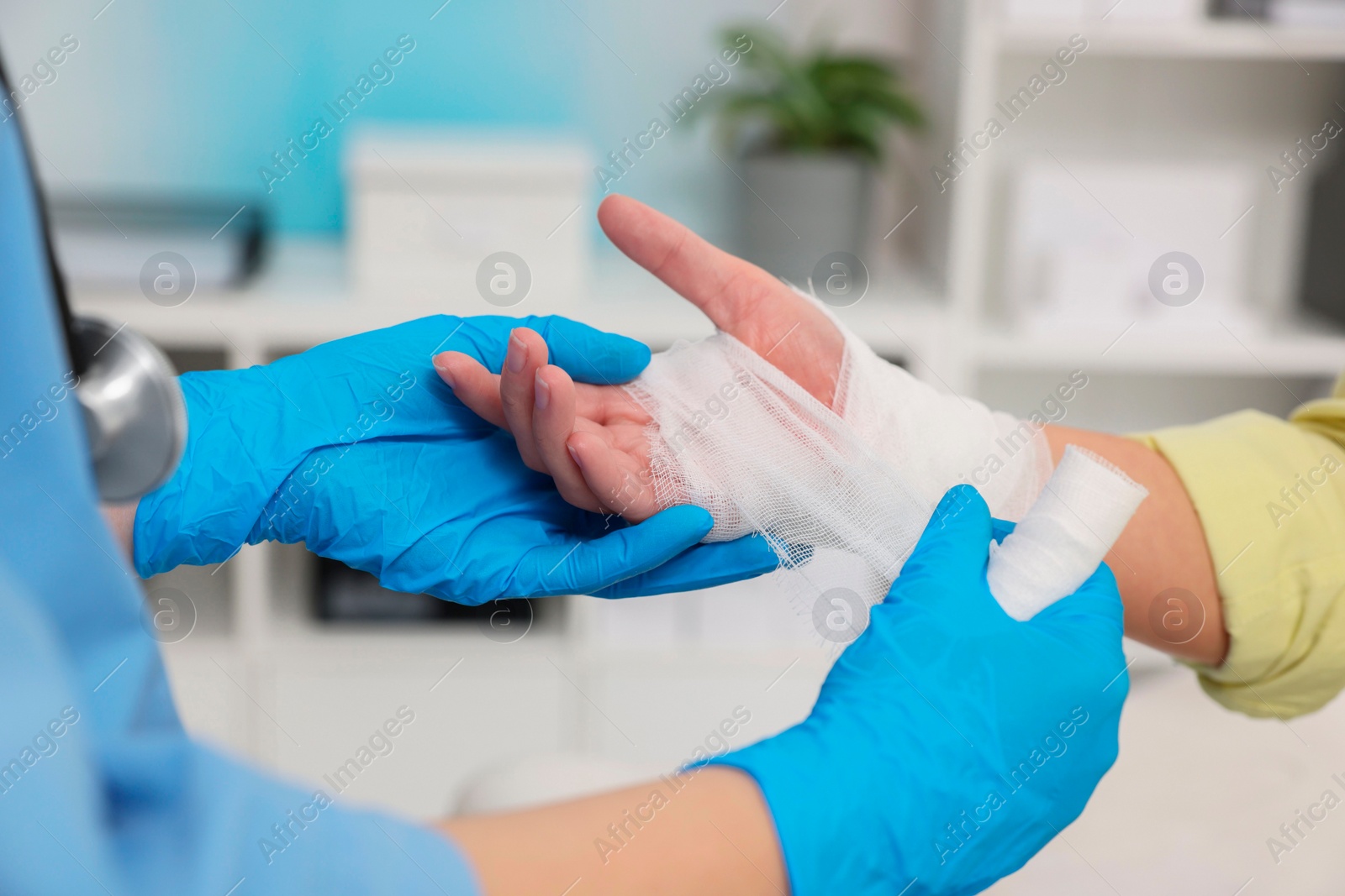 Photo of Doctor bandaging patient's burned hand in hospital, closeup