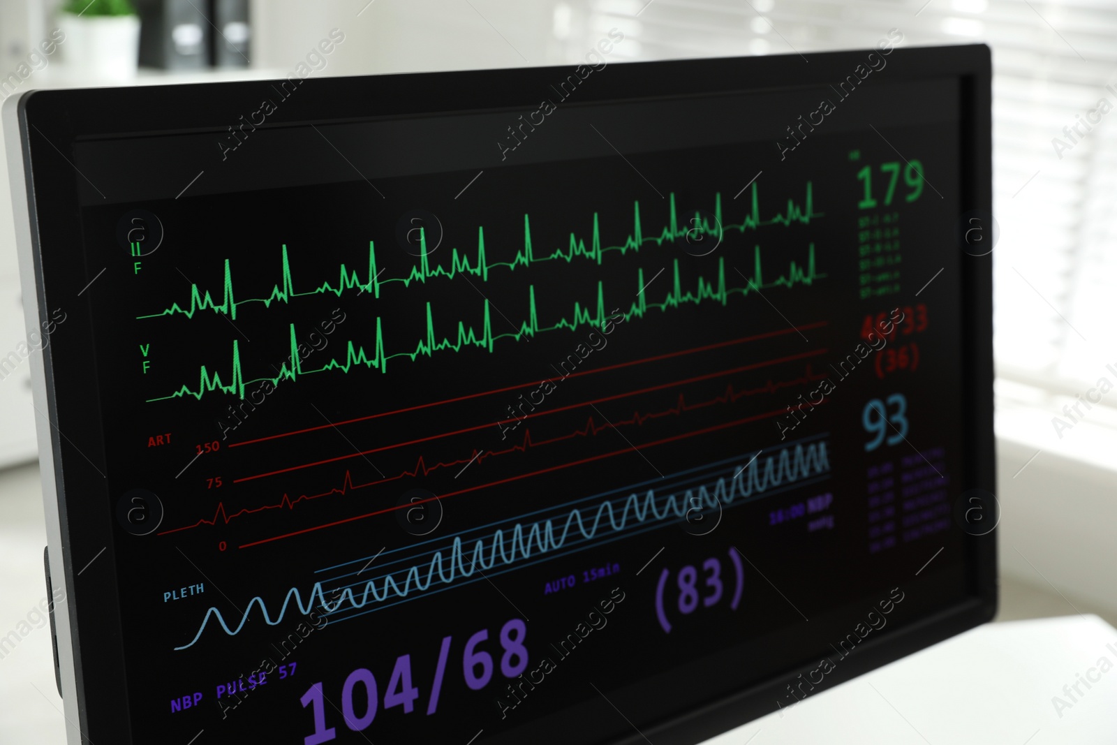 Photo of Black monitor with cardiogram in hospital, closeup