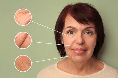 Beautiful mature woman on olive background. Zoomed skin areas showing wrinkles before rejuvenation procedures