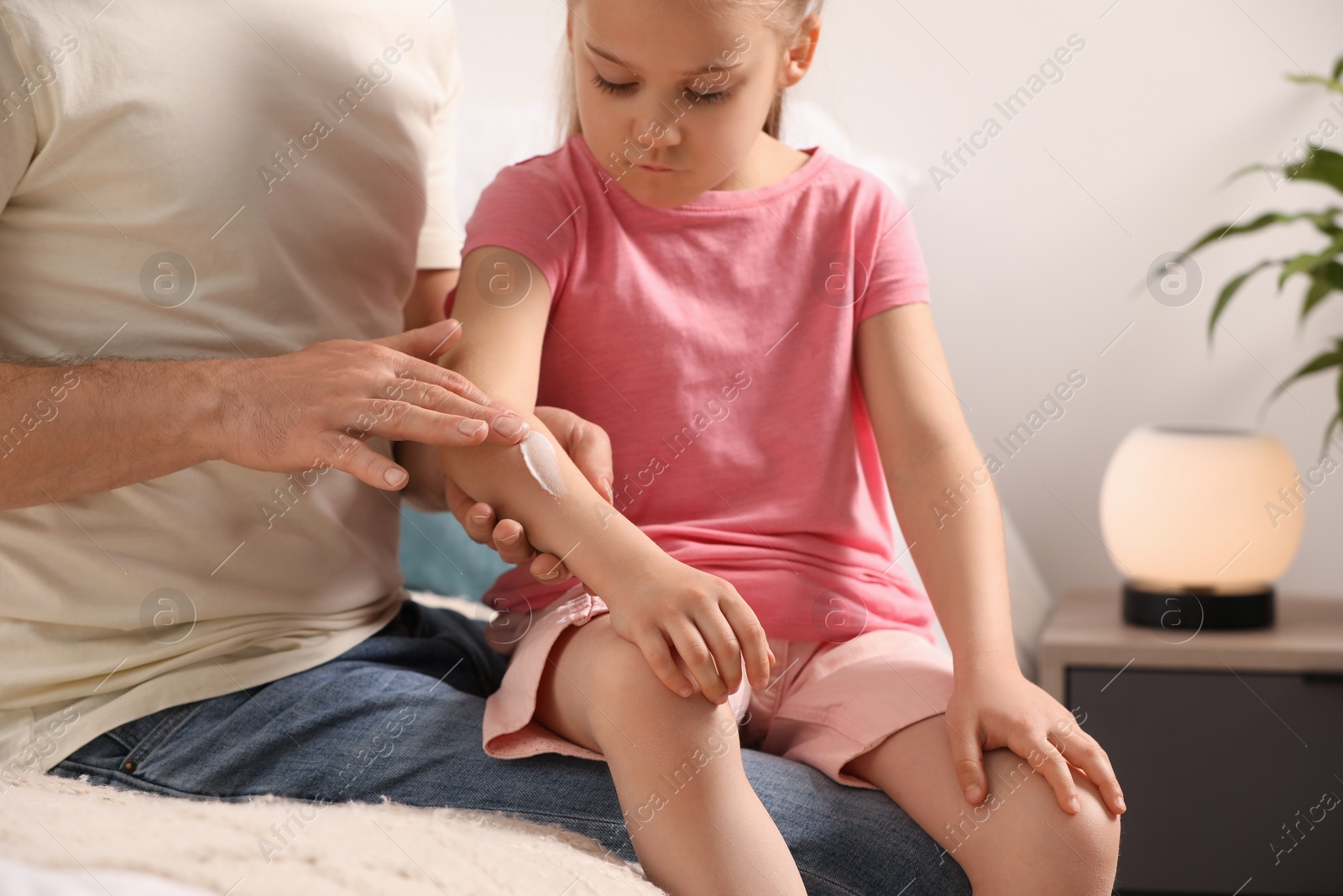 Photo of Father applying ointment onto his daughter's arm indoors