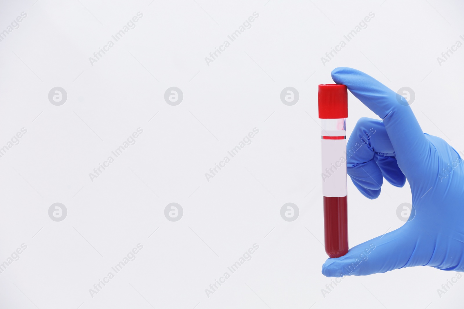 Photo of Scientist holding test tube with blood sample against light background. Space for text