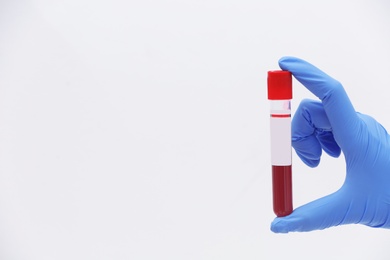 Scientist holding test tube with blood sample against light background. Space for text