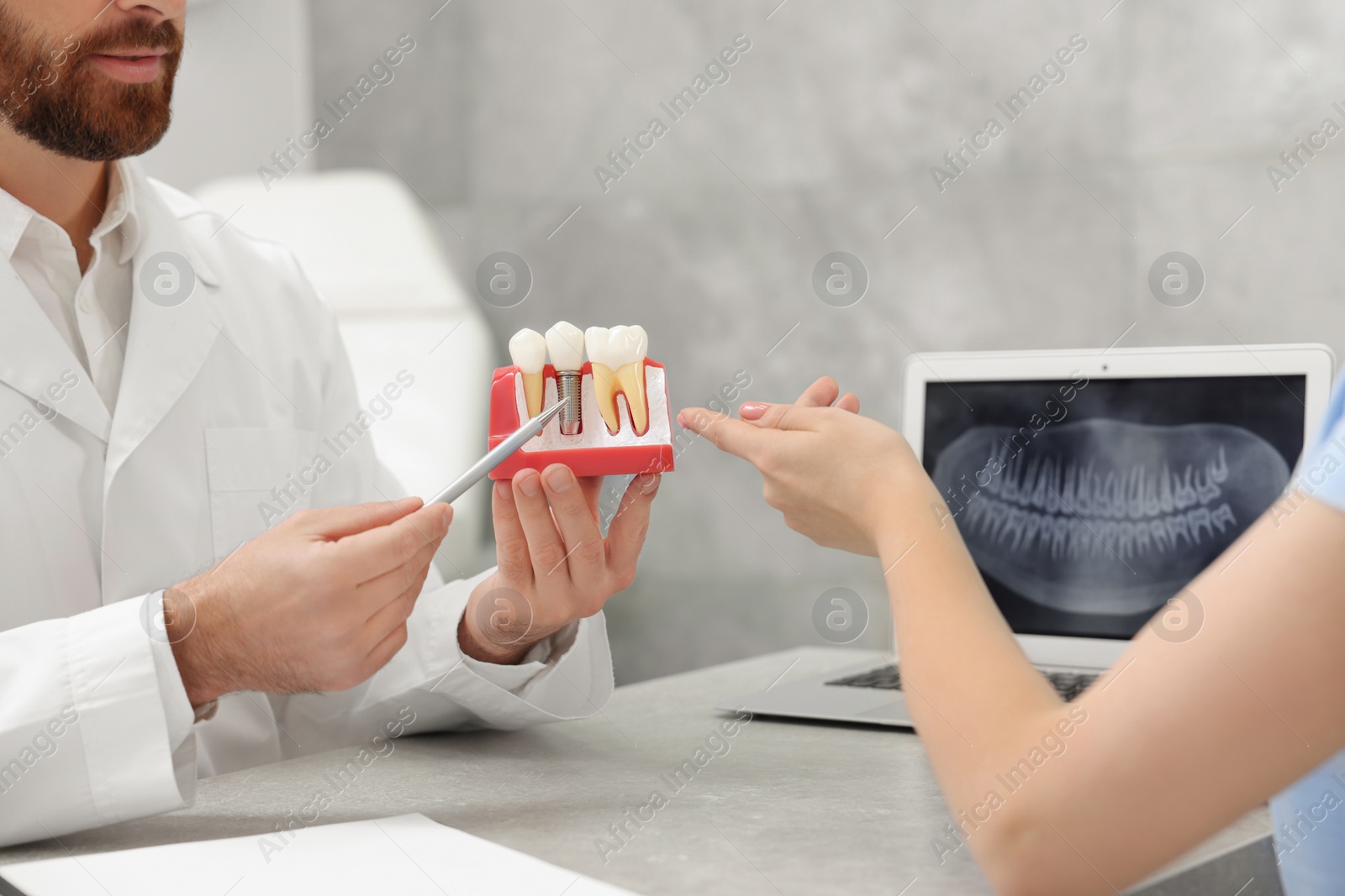 Photo of Doctor showing patient educational model of dental implant in clinic, closeup