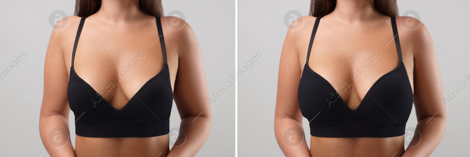 Image of Woman before and after breast augmentation on light grey background, closeup. Collage with photos showing difference between breast sizes