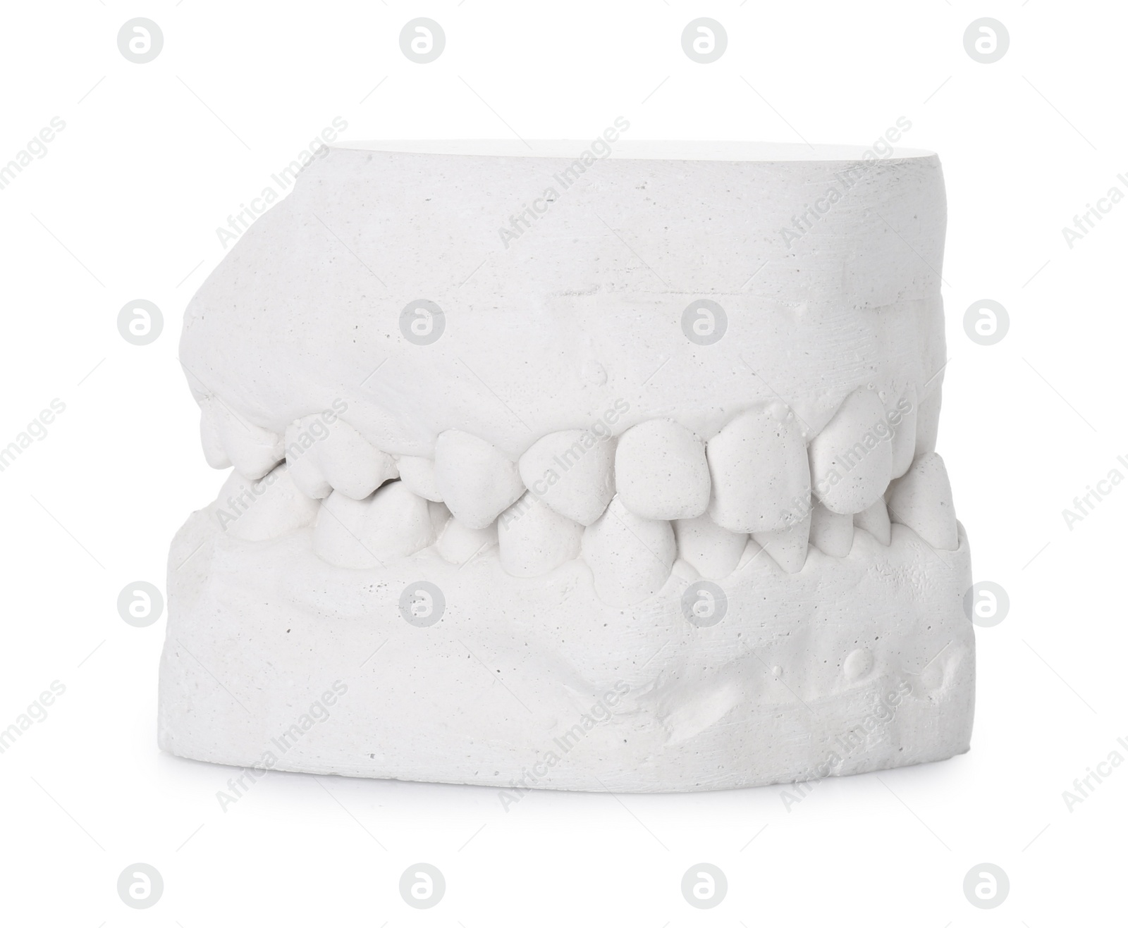 Photo of Dental model with gums isolated on white. Cast of teeth