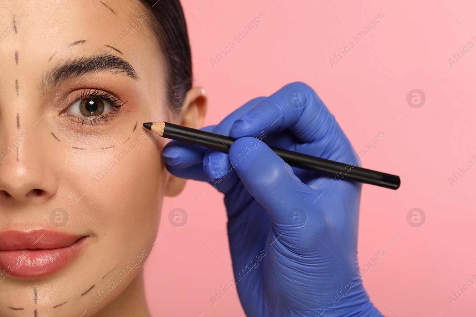 Photo of Doctor with pencil preparing patient for cosmetic surgery operation on pink background, closeup