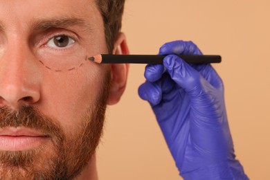 Doctor drawing marks on man's face for cosmetic surgery operation against beige background, closeup