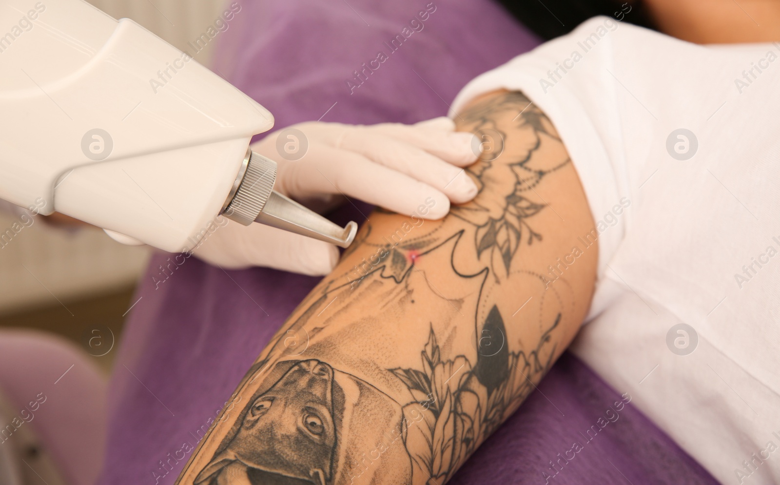 Photo of Young woman undergoing laser tattoo removal procedure in salon, closeup