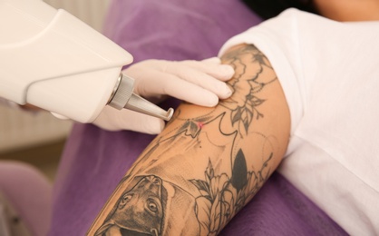 Young woman undergoing laser tattoo removal procedure in salon, closeup