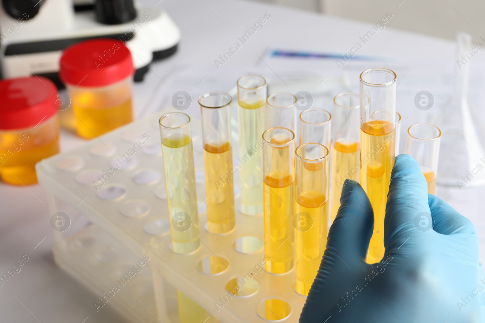 Photo of Nurse holding tube with urine sample at table, closeup. Specimen collection