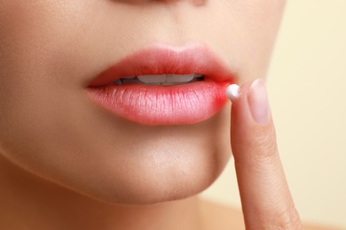 Photo of Young woman with cold sore applying cream onto lips against beige background, closeup