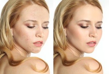 Image of Photo before and after retouch, collage. Portrait of beautiful young woman on white background