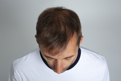Photo of Man with hair loss problem on light grey background, above view