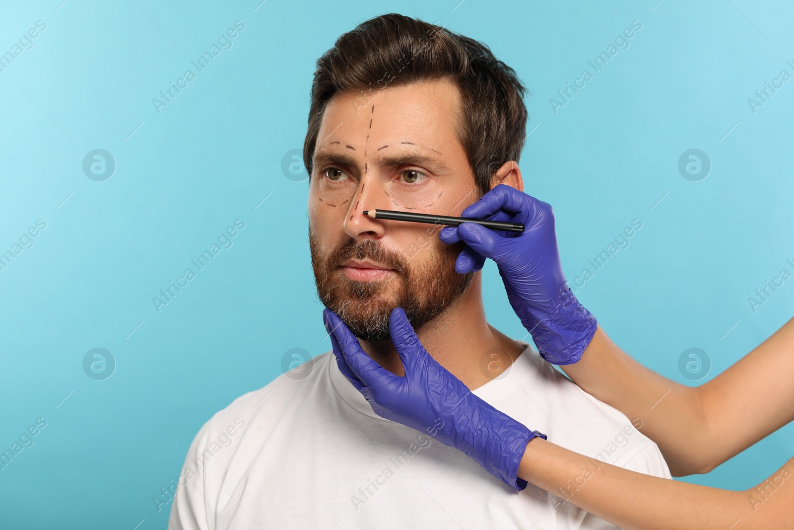 Photo of Doctor with pencil preparing patient for cosmetic surgery operation on light blue background