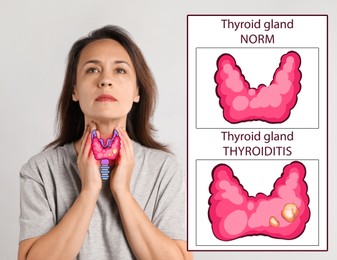 Woman and illustration of thyroid gland on white background