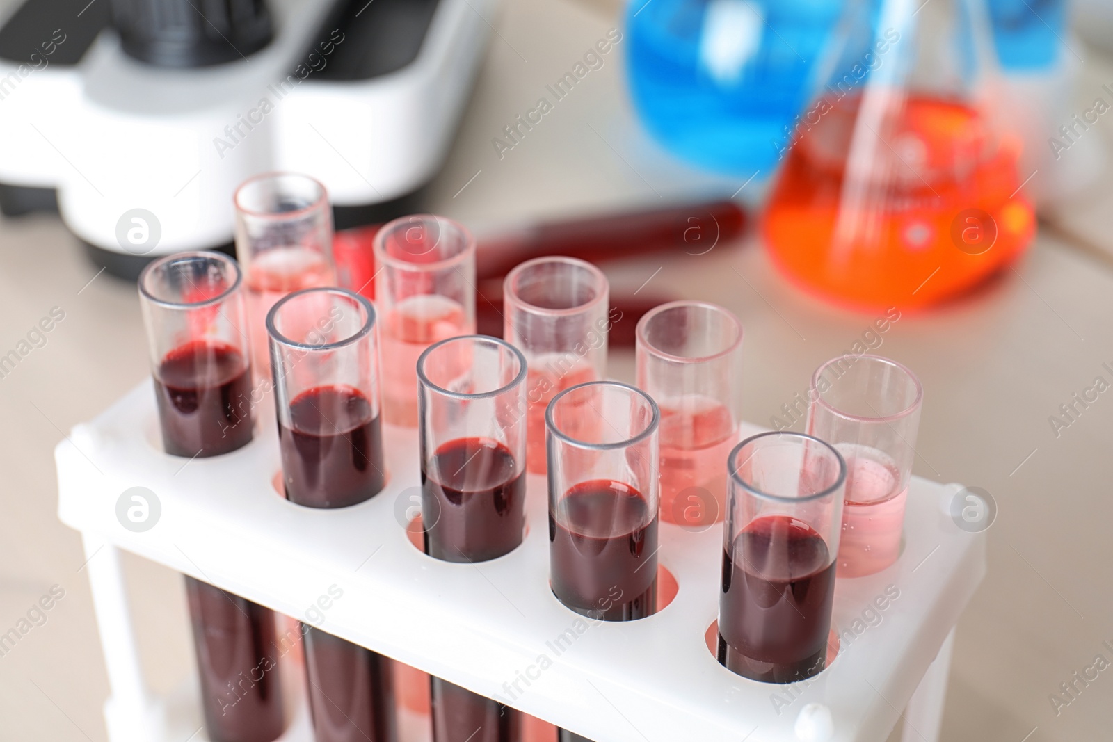 Image of Test tubes with blood samples in rack on table, closeup. Laboratory analysis