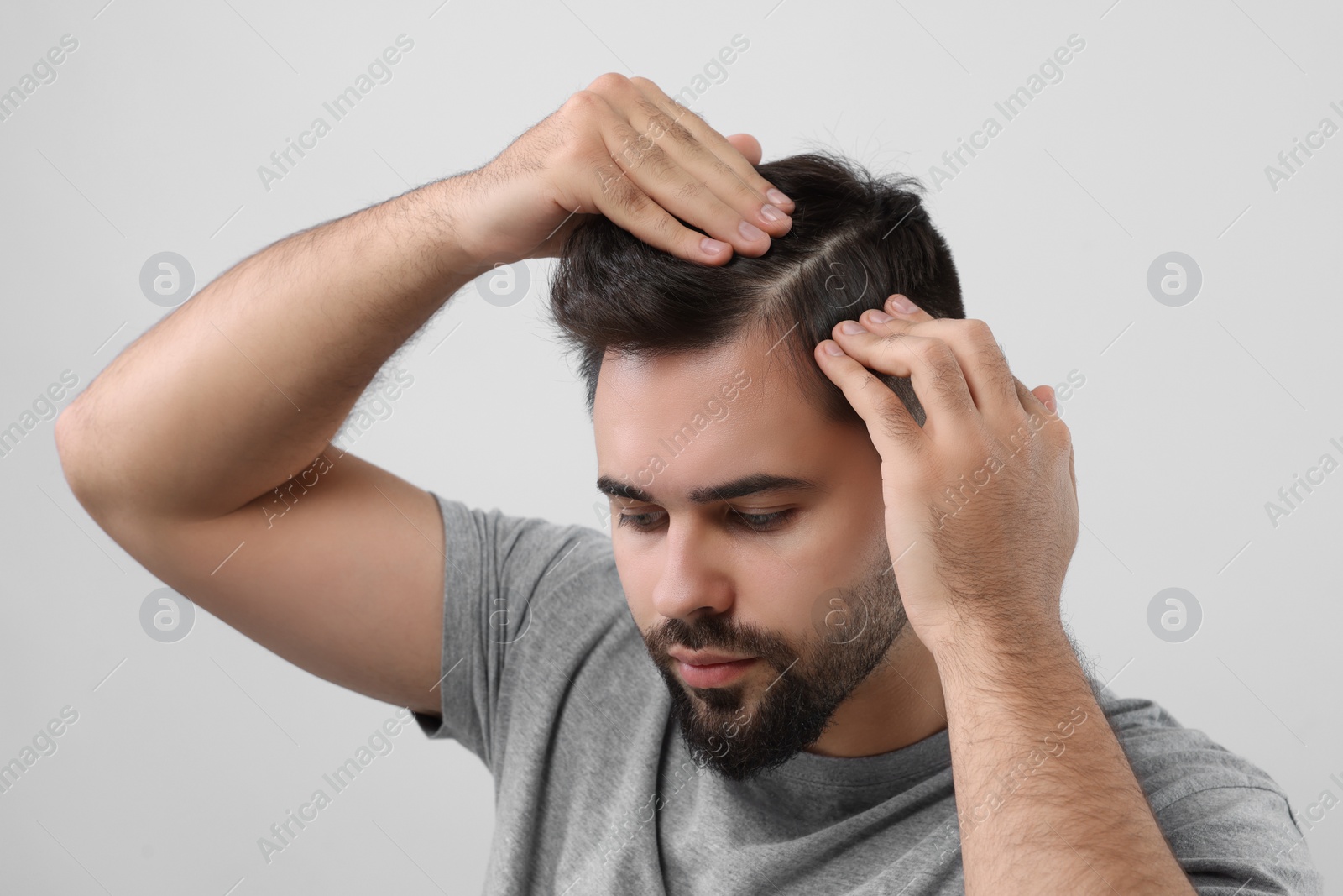 Photo of Man examining his head on light grey background. Dandruff problem