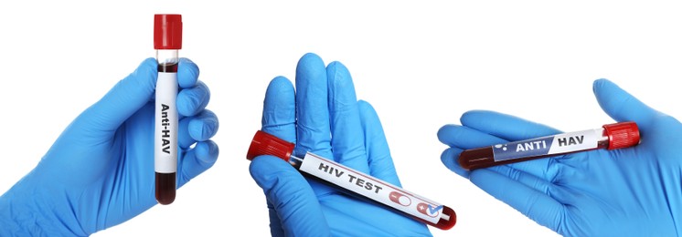 Collage with photos of scientists holding test tubes with blood samples on white background, closeup. Banner design