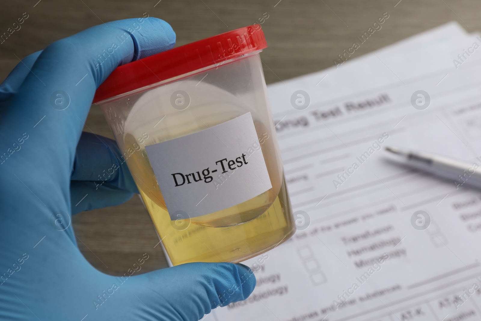 Photo of Drug test. Laboratory worker holding container with urine sample at table, closeup