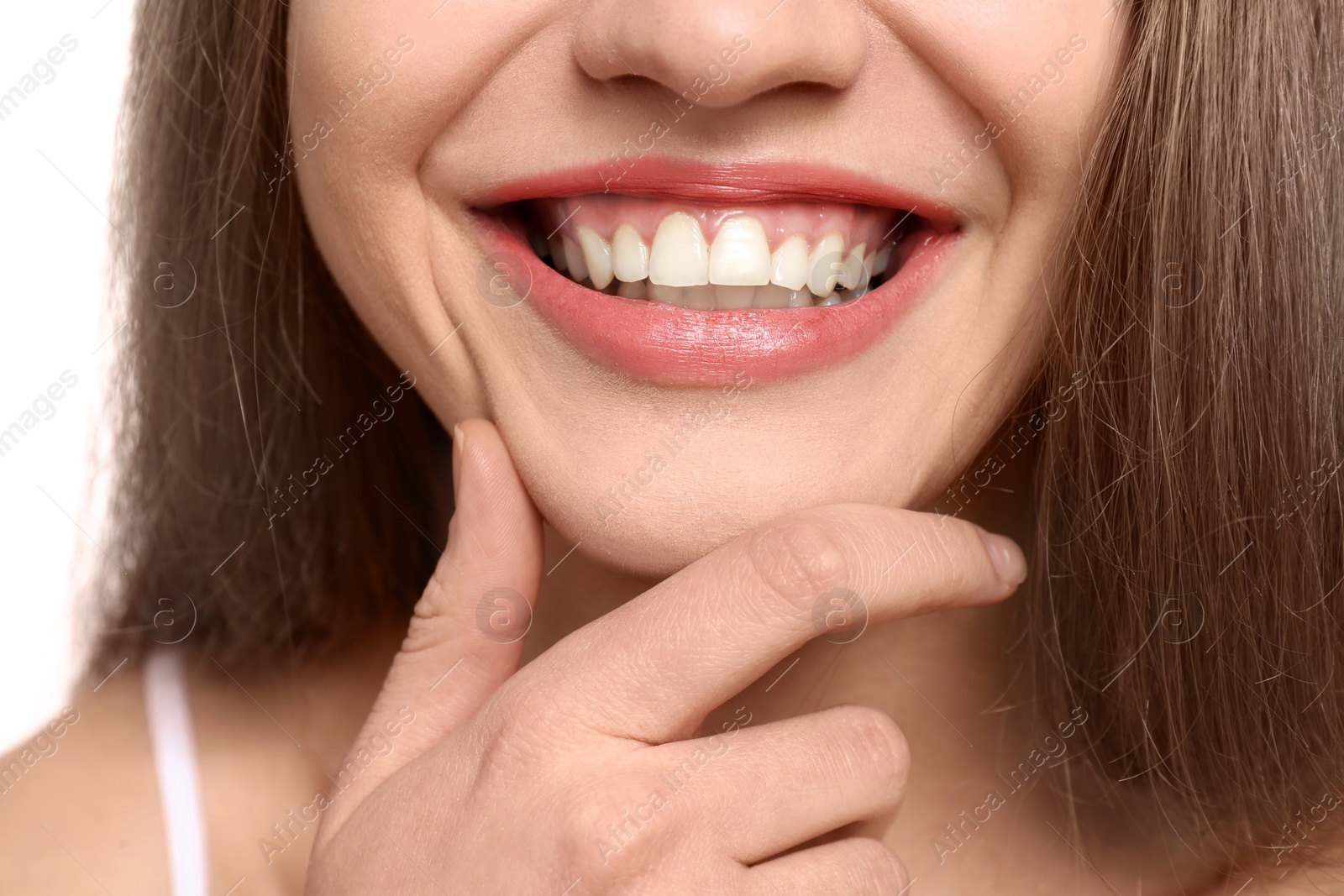 Photo of Young woman with beautiful smile, closeup. Teeth whitening