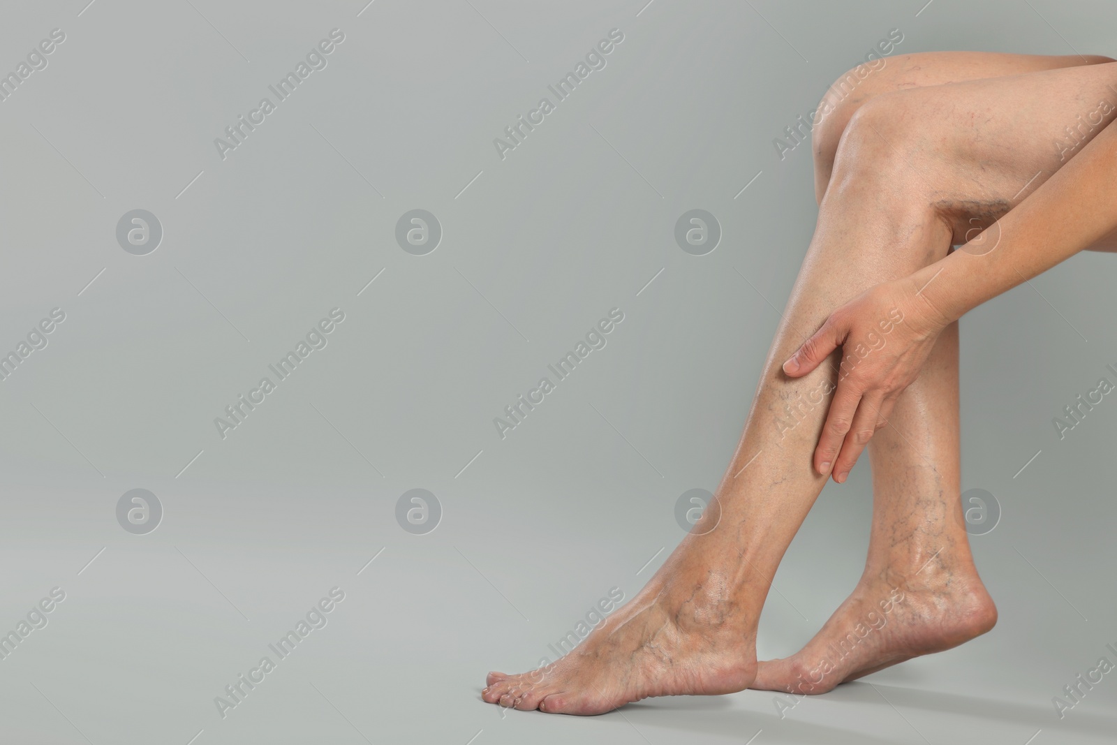 Photo of Closeup view of woman suffering from varicose veins on light grey background. Space for text