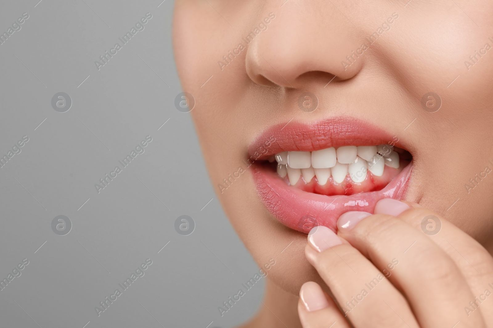 Image of Woman showing inflamed gum on grey background, closeup. Space for text