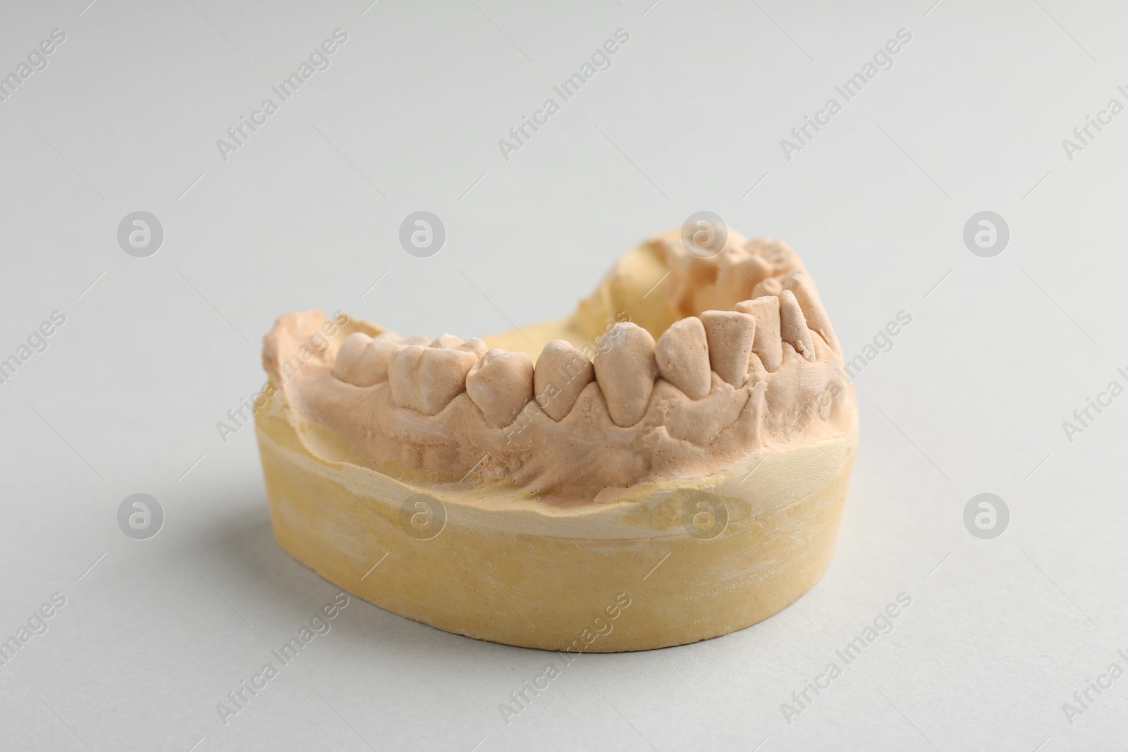 Photo of Dental model with gums on light grey background. Cast of teeth