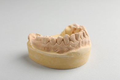 Photo of Dental model with gums on light grey background. Cast of teeth