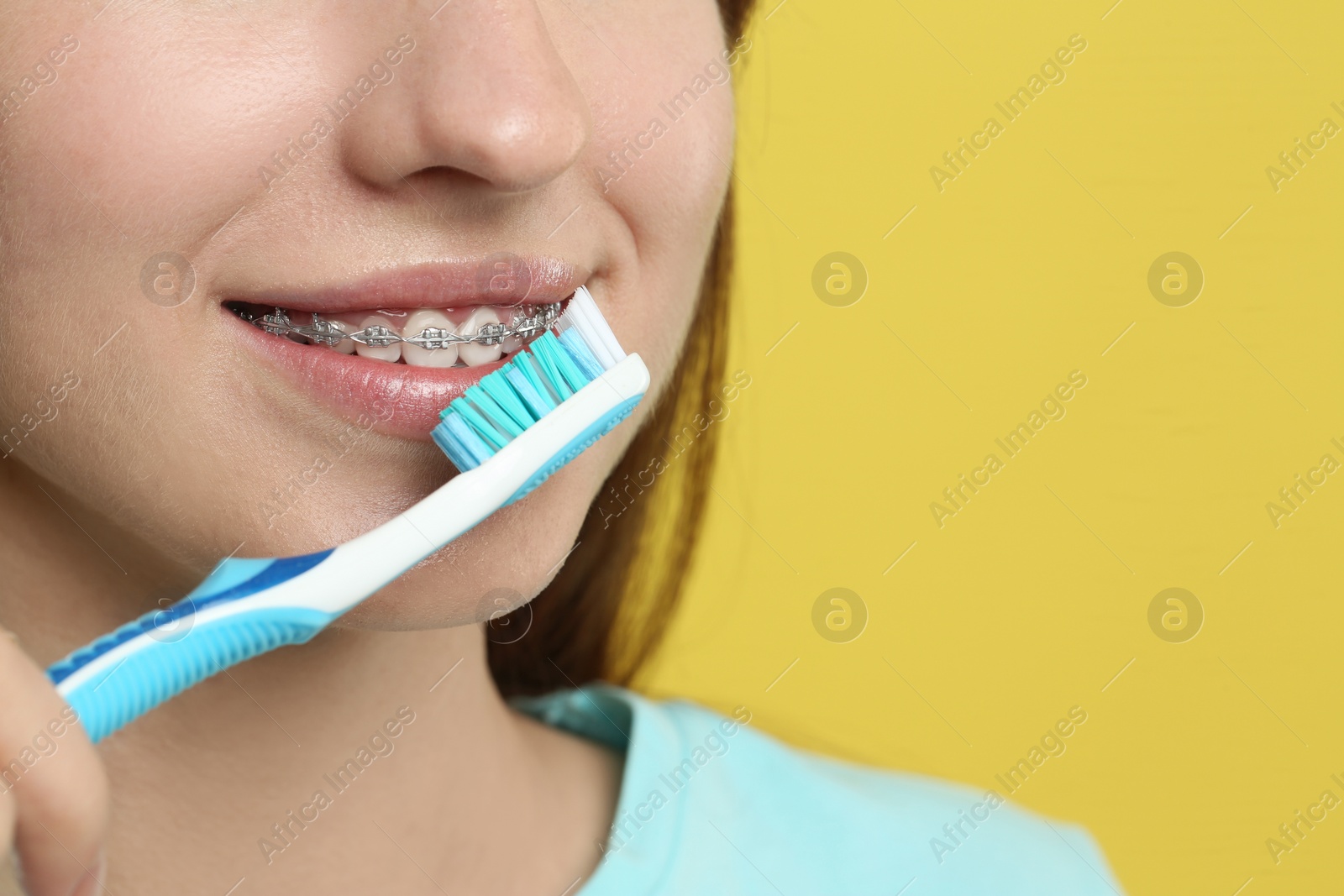 Photo of Smiling woman with dental braces cleaning teeth on yellow background, closeup. Space for text