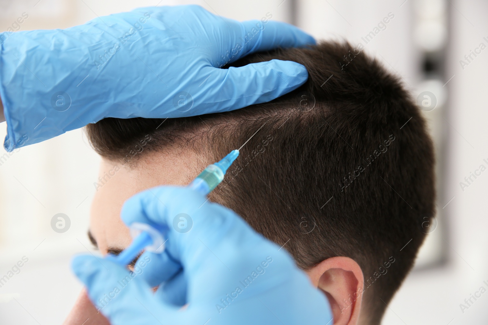 Photo of Young man with hair loss problem receiving injection on blurred background, closeup