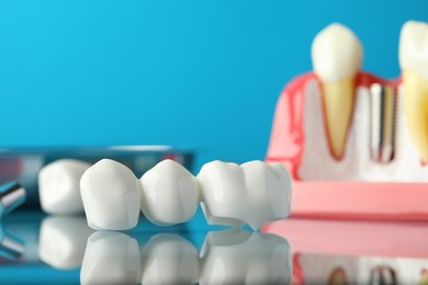 Dental bridge near educational model of gum with implant on light blue background, closeup