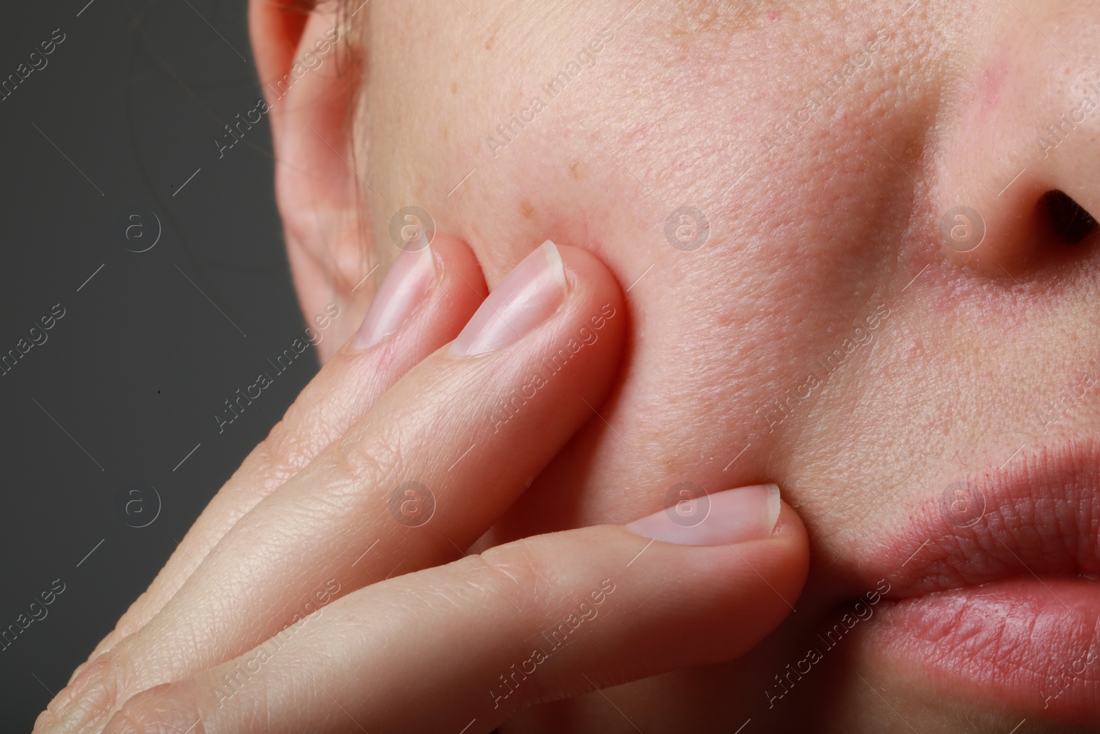 Photo of Closeup view of woman with healthy skin on grey background