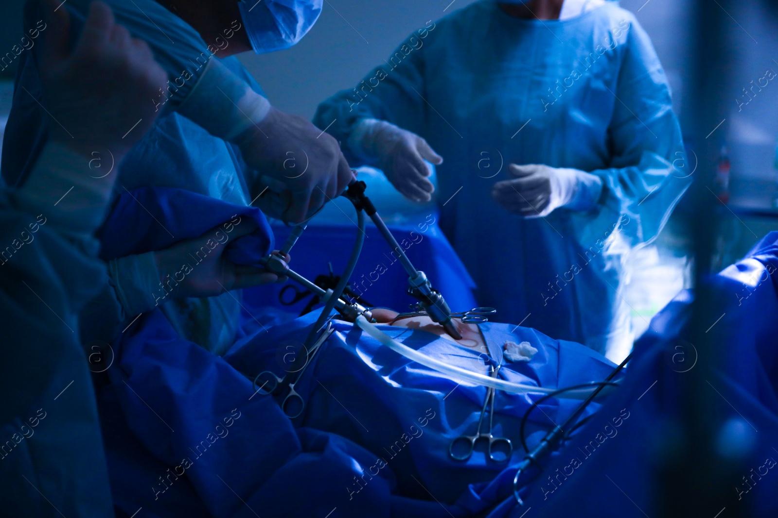 Photo of Medical team performing surgery in operating room, closeup