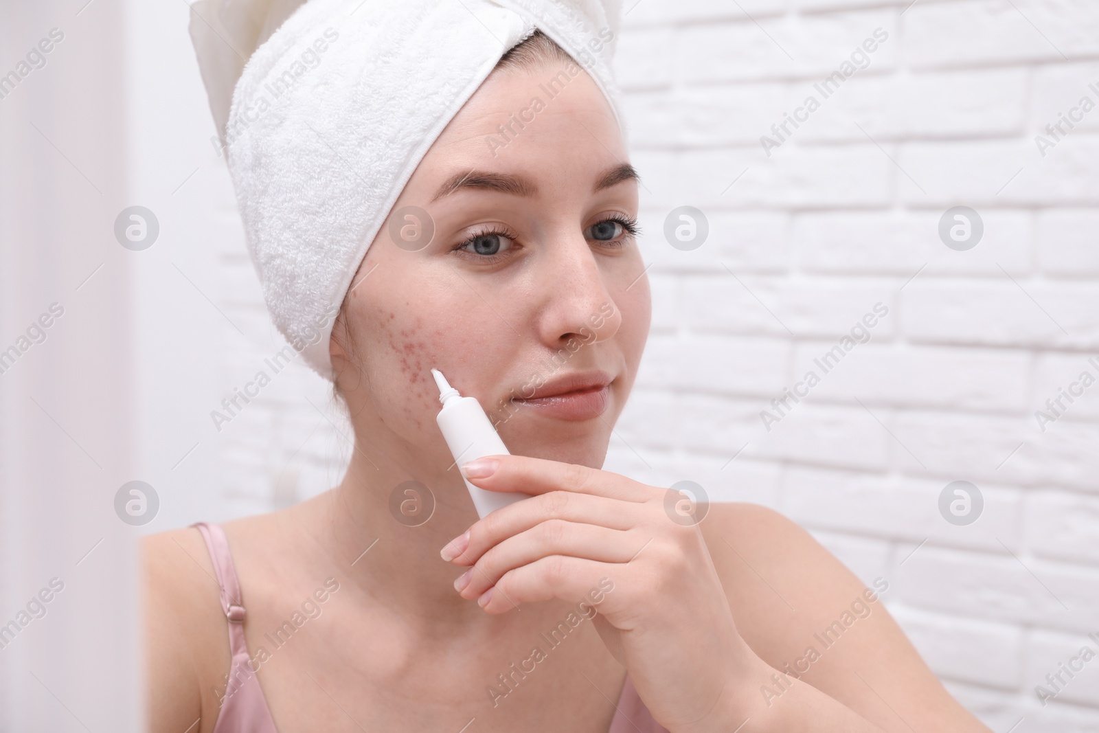 Photo of Woman with acne problem applying cream near mirror indoors