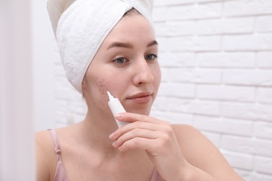 Photo of Woman with acne problem applying cream near mirror indoors