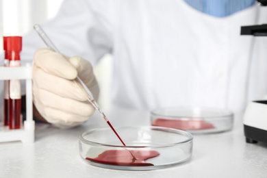 Photo of Scientist taking blood sample from Petri dish with pipette in laboratory, closeup. Virus research