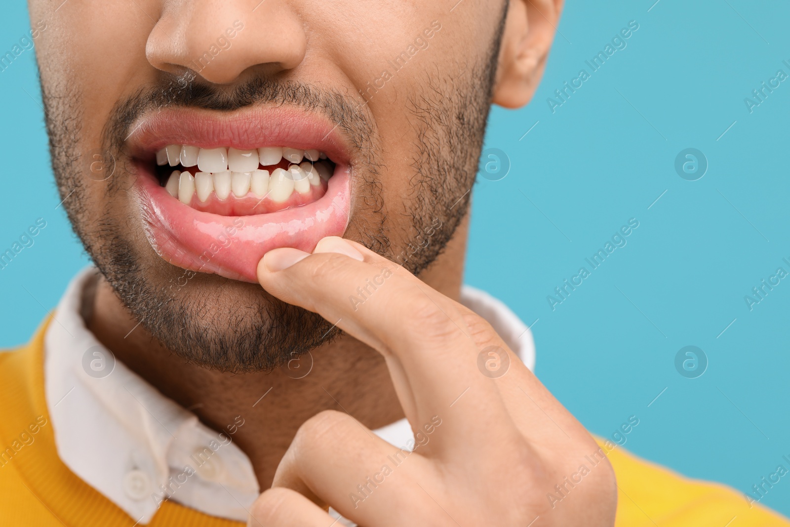 Photo of Man showing his healthy teeth and gums on light blue background, closeup