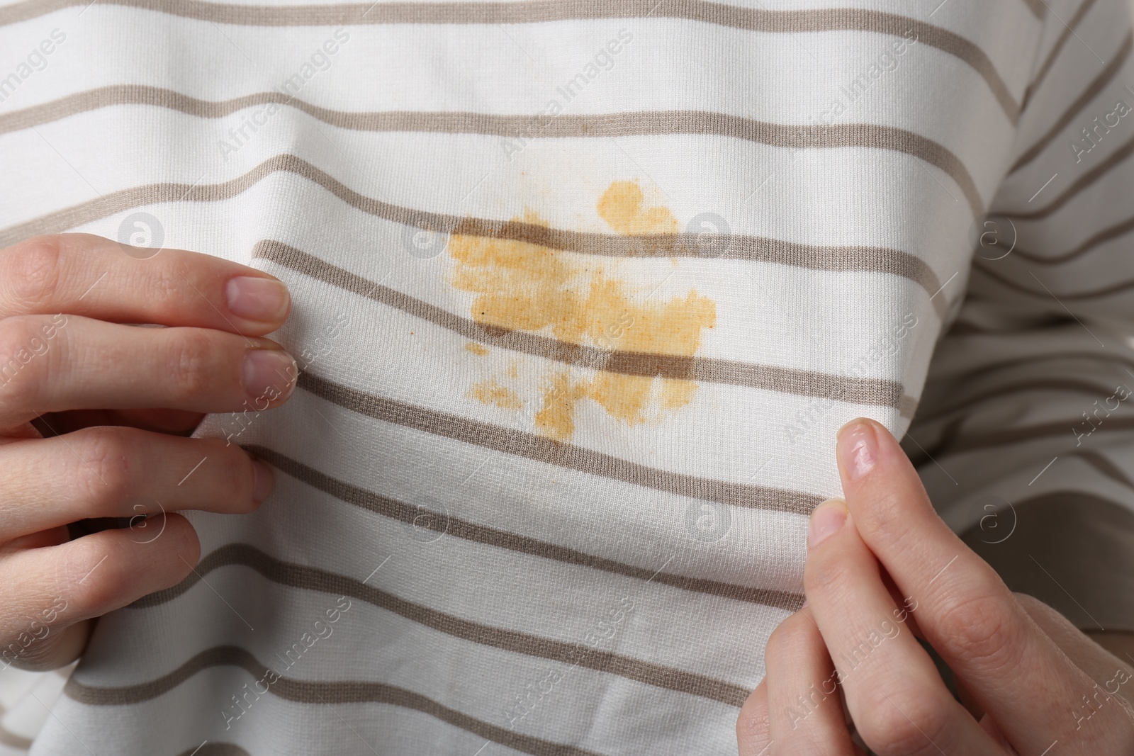 Photo of Woman showing shirt with yellow stain, closeup