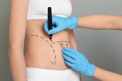 Doctor drawing marks on female belly for cosmetic surgery operation, closeup