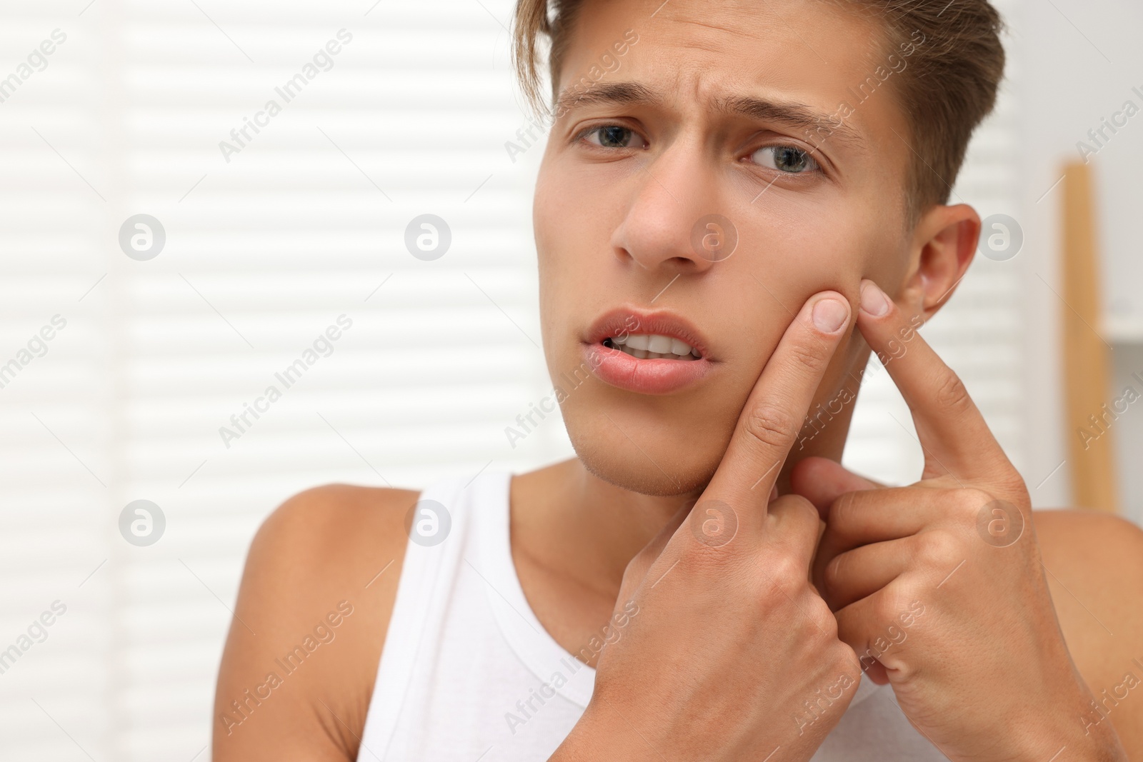 Photo of Upset young man popping pimple on his face indoors. Acne problem